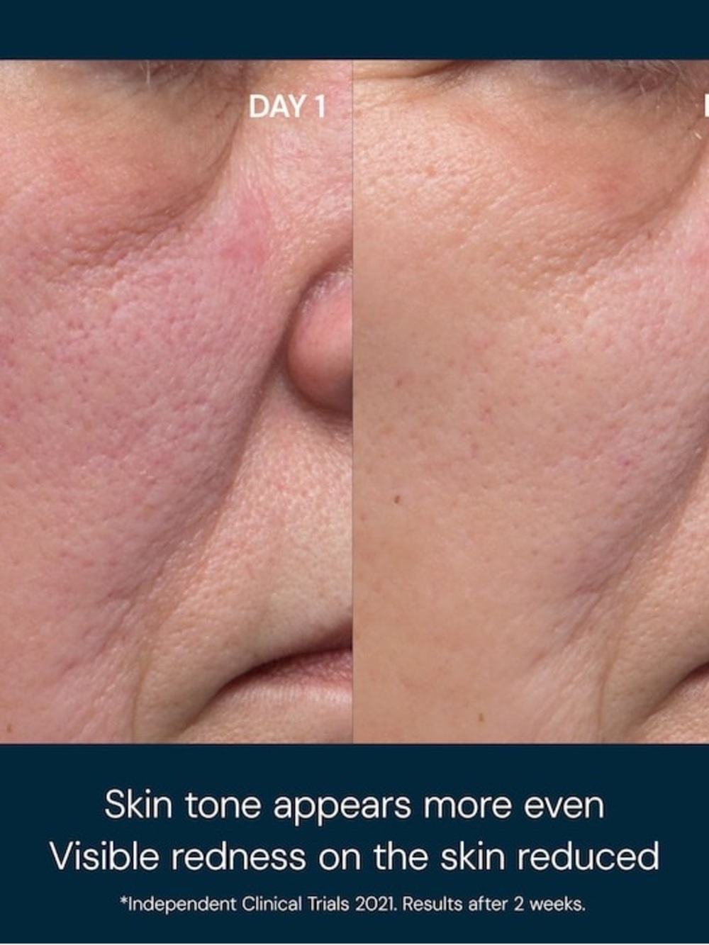 Elemis Dynamic Gentle Resurfacing Pads with Lactic Acid - Picture 2 of 9